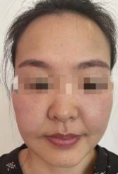 体验前-洁铭新加坡医美