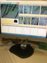 点击看大图 -菩叶头皮抗衰