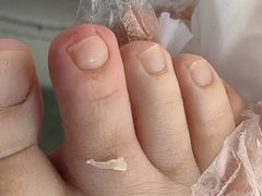 -新甲连锁灰指甲·甲沟炎·鸡眼(黑龙江路店)