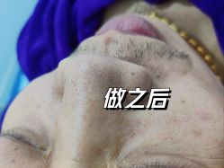 -蕾特恩专业祛痘·皮肤管理