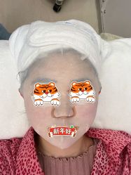 体验后-北京楚诺医疗美容