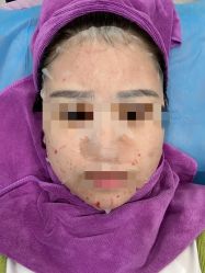 体验后-北京米扬丽格医疗美容·联合丽格鼻整形中心