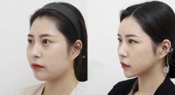 -CMS西美斯·美式医疗美容