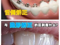 -团圆口腔·种植中心(锦江院区)