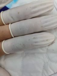 -蕾特恩专业祛痘国际连锁