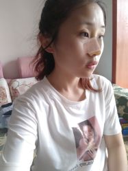 点击看大图 体验后-鑫元辰医疗美容整形
