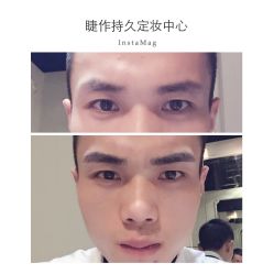 iphone_upload_pic-光SPA科技美肤