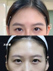 -Yestar重庆艺星医疗美容医院
