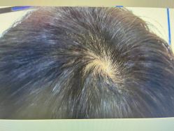 -雍禾植发全国连锁