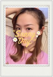 点击看大图 -大麦微针植发全国连锁