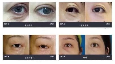 -Yestar艺星医疗美容医院