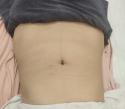 -Lily纤美·科技减脂中心