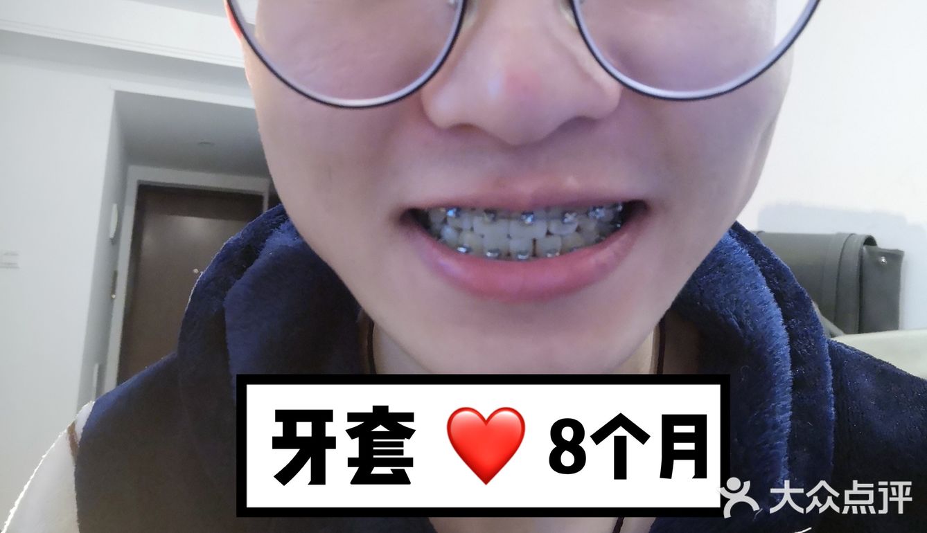 【案例分享】今天我们来讲个小帅哥的正畸案例