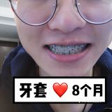 【案例分享】今天我们来讲个小帅哥的正畸案例