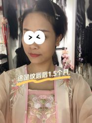 体验后-广东韩妃整形外科医院