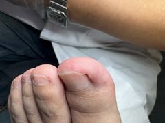 -新甲连锁灰指甲·甲沟炎·鸡眼(黑龙江路店)