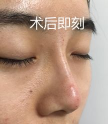 -八大处整形