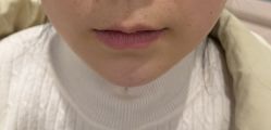 -Yestar 嘉兴艺星医疗美容医院