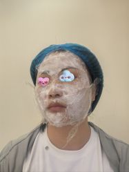 -海涛医疗美容·面部抗衰·注射美鼻