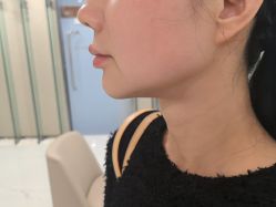 点击看大图 -Yestar艺星整形美容医院