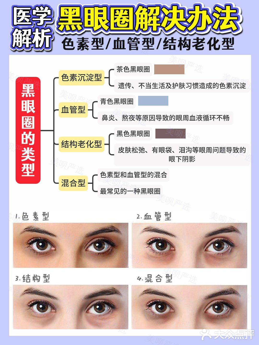 黑眼圈医学分析｜医美项目选择+眼霜成分草单