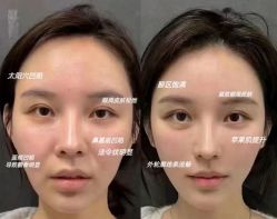 -Yestar 嘉兴艺星医疗美容医院