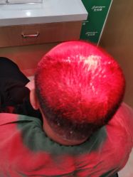 -雍禾植发全国连锁