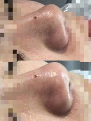 -skin79皮肤管理中心