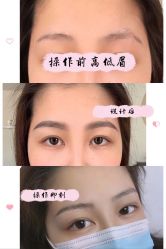 -久匠半永久纹眉