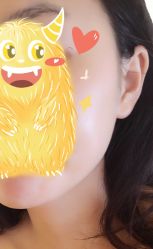 -宥莉·ULLY 痘敏肌•科技皮肤管理中心