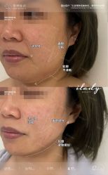 点击看大图 -MLP美丽派·问题肌疗愈中心