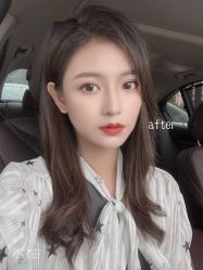 -广州美莱医疗美容医院