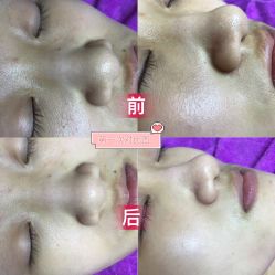 -蕾特恩祛痘•皮肤管理