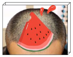 -大麦微针植发全国连锁