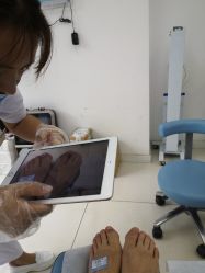 -派恩宜灰指甲鸡眼嵌甲手足癣