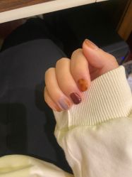 -U-Nail