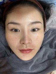 体验后-深圳广和门诊部·整形医疗美容