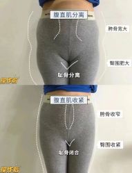 -Fundi张玉珊修身堂·indiba·BTL科技瘦身