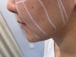 点击看大图 体验前-重庆联合丽格第五医疗美容医院