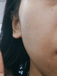 体验前-重庆军美医疗美容医院