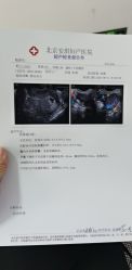 -北京安琪