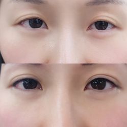 -平萍纹绣韩式半永久定妆