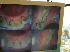 -赫尔森口腔·牙齿种植修复