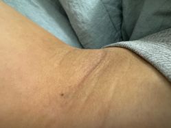 体验后-杭州奥拉克医疗美容门诊部