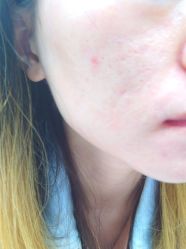 体验后-JS医疗美容