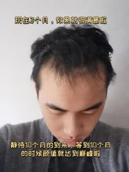 -雍禾植发全国连锁