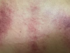 -沈师傅盲人按摩工作室(密三小区店)