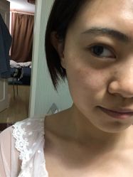 体验后-坤如玛丽·医疗美容中心
