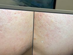 -苑苑vbeauty科技美容SPA