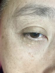 -清疣美疣·痣·斑净肤中心